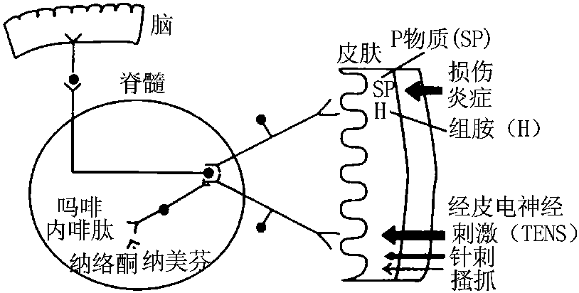 一、自覺癥狀
